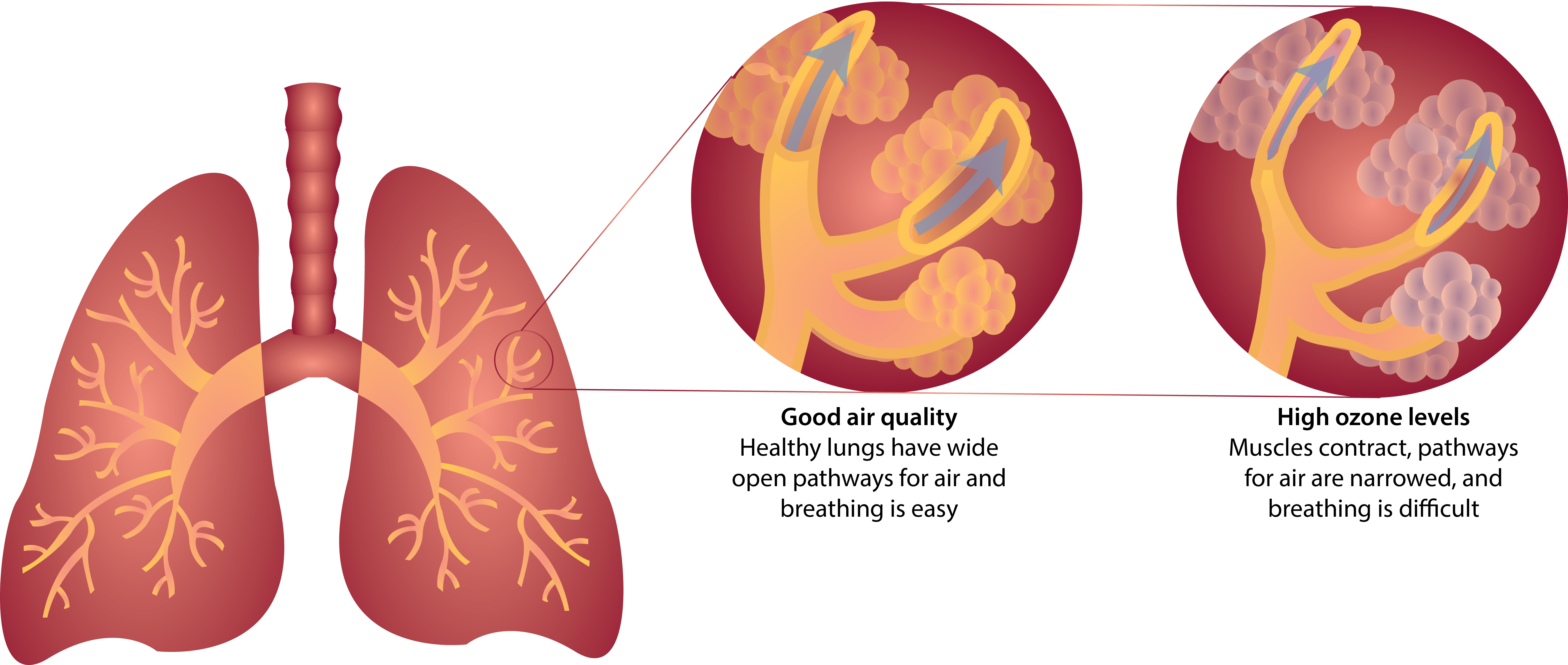 The Effects of Ozone on Human Lungs